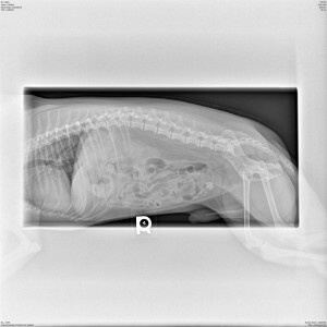 Bladder Stone X-Ray